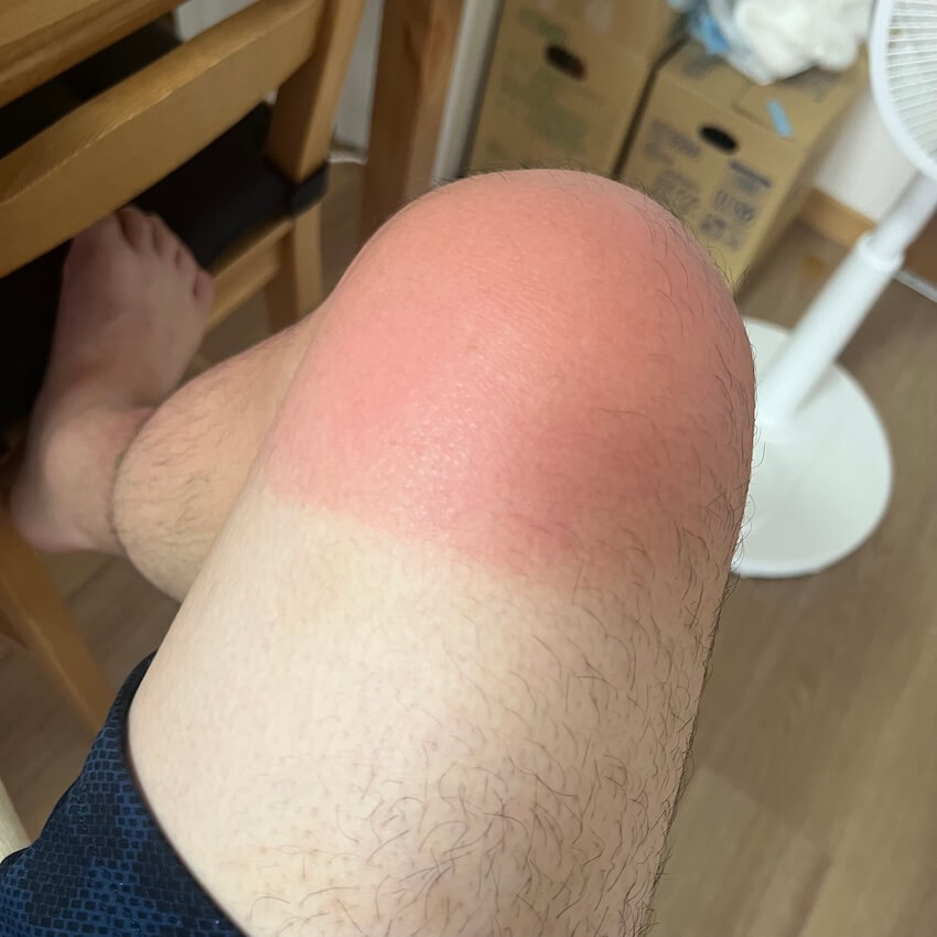 日焼けした足
